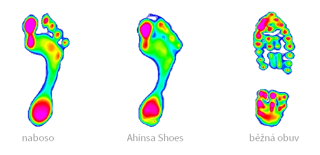 Ahinsa Shoes - měření plantárních tlaků